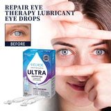 EELHOE Eye Drops for Redness Relief & Moisturizing